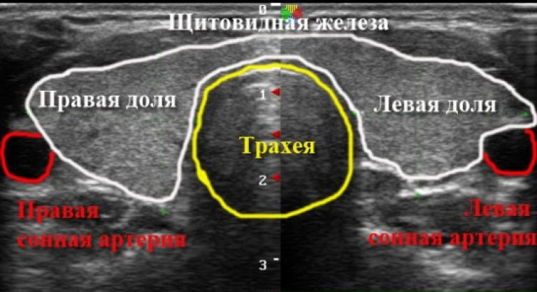 узи щитовидной железы подготовка к исследованию